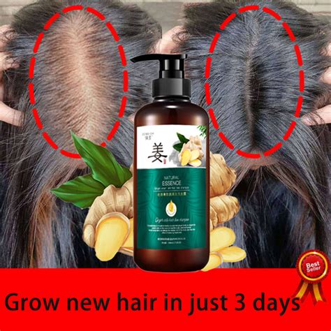 500ml natural ginger shampoo for hair loss herbal ginger extract shampoo hair grower for women