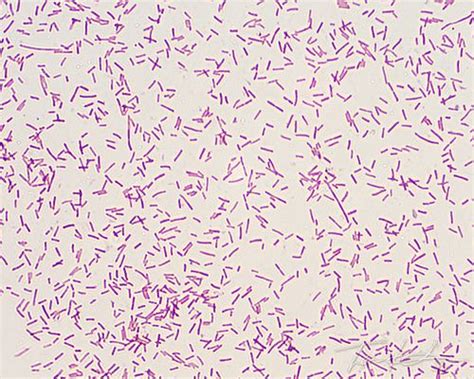Bacillus Subtilis Simple Stain
