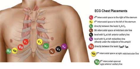 Illustrations Electrocardiology Instruction