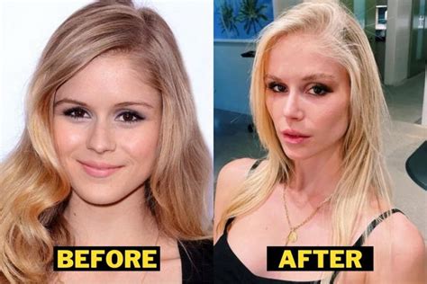 Erin Moriarty Got Plastic Surgery Her Before And After Photos Go Viral