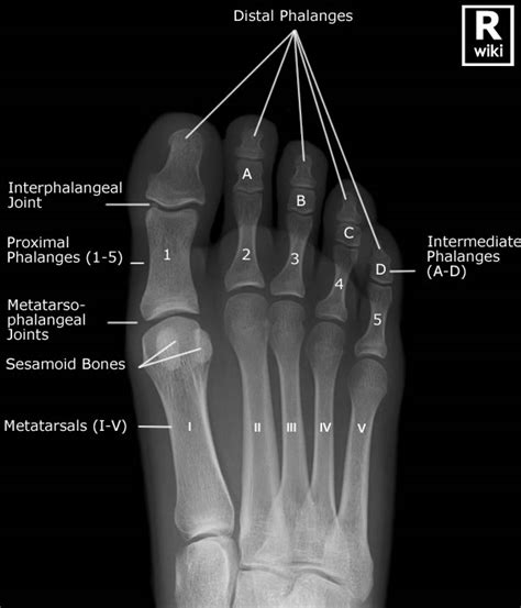 Foot X Ray Anatomy