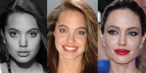 How Many Times Did Angelina Jolie Have Plastic Surgery Quora