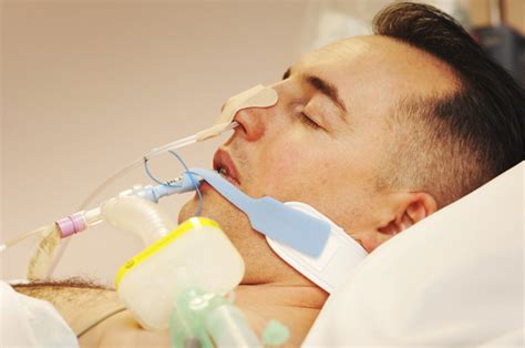 Ensuring Patient Safety When Using A Nasogastric Feeding