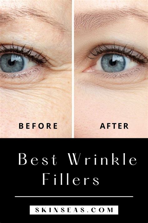 Best Wrinkles Creams Serums And Fillers In 2021 Best Wrinkle Filler