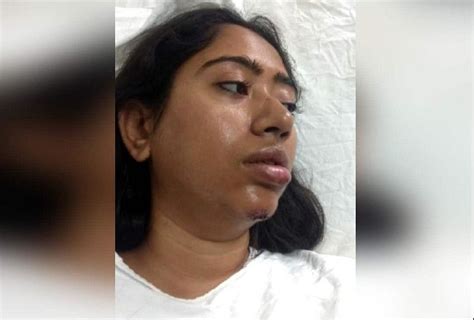 महिला पत्रकार से झपटमारी मामले में नया मोड़ सीसीटीवी में दिखे आरोपी तीन पुलिसकर्मी सस्पेंड