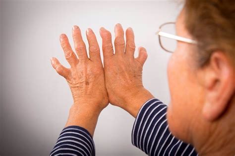 El ejercicio físico mejora los síntomas de la artritis reumatoide