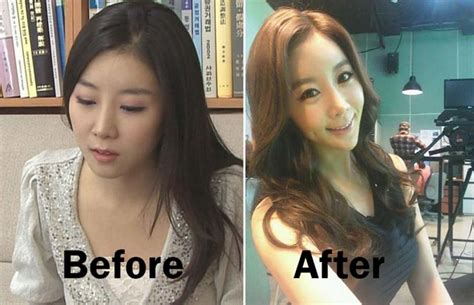 South Korean Reporter Ruins Her Face With Plastic Surgery World News