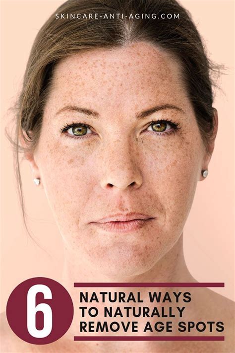 The Truth Behind Brown Spots On Face Brown Spots On Face Spots On