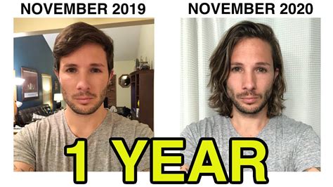 Hair Growth Time Lapse 1 Year Mens Hair Growth Youtube