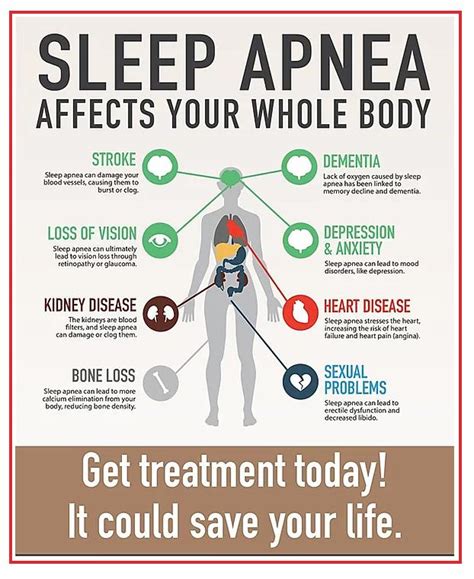 What Is Sleep Apnea New Jersey Sleep Apnea Solutions