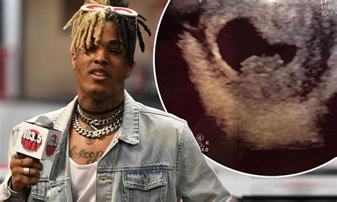 XXXTentacion S Mom Hints That The Late Rapper Was Having A Baby Daily