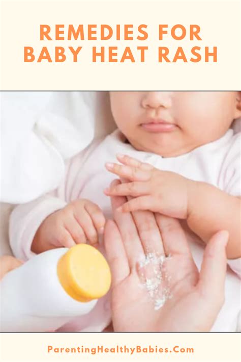 Baby Heat Rash 15 Must Know Home Remedies For Baby Heat Rash Baby