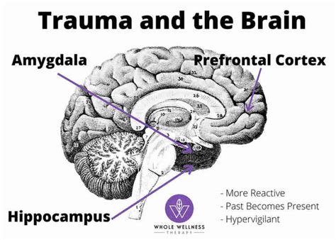 How Does Trauma Affect The Brain And What It Means For You
