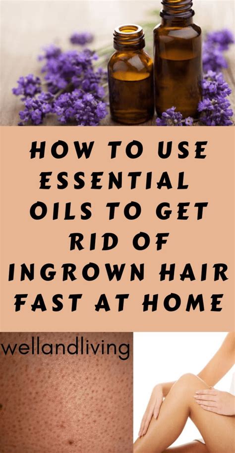 How To Use Essential Oils To Get Rid Of Ingrown Hair Fast At Home