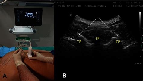 A Position And Orientation Of The Ultrasound Transducer During A