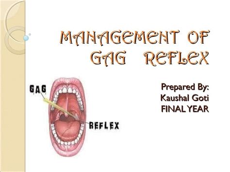 Gag Reflex Management