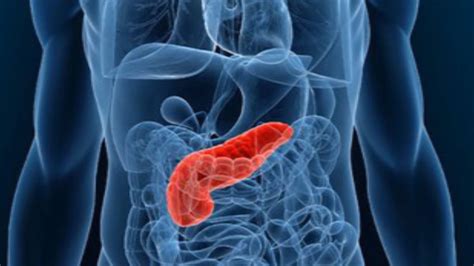 Iit Researchers Make Implantable Pancreas For Treating Diabetes