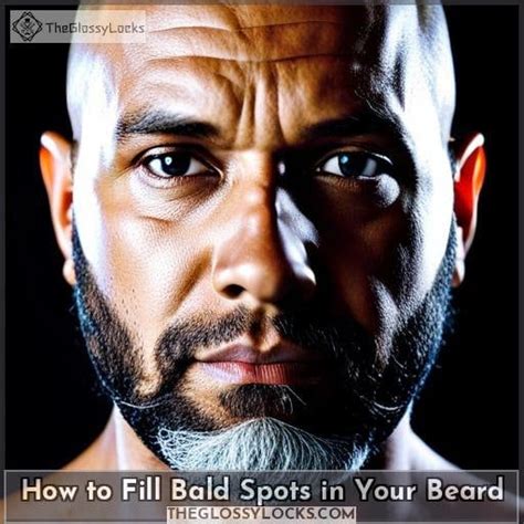 Fix Beard Bald Spots Causes Treatments And Home Remedies