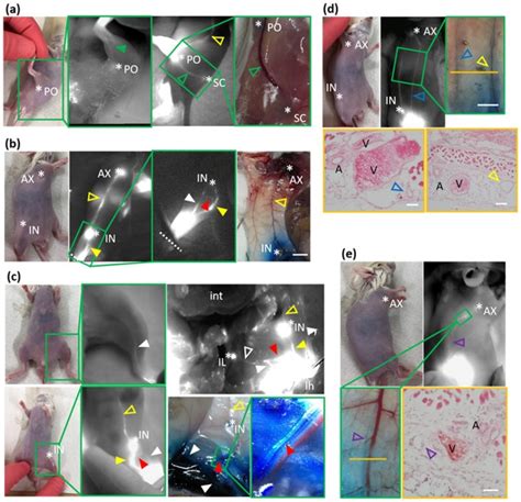 Near Infrared Fluorescence Imaging Directly Visualizes Lymphatic