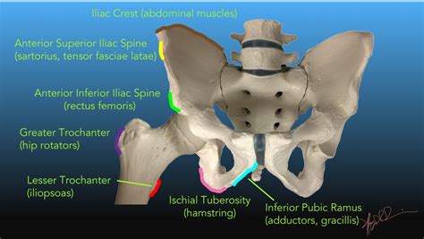 Avulsion Fracture Hip Iliac Crest