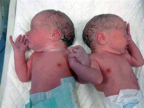 This Photo Is Running The World Twin Brother And Sister Born In Spain