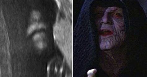 Stars Wars Emperor Palpatine Appears In Babys Ultrasound Scan