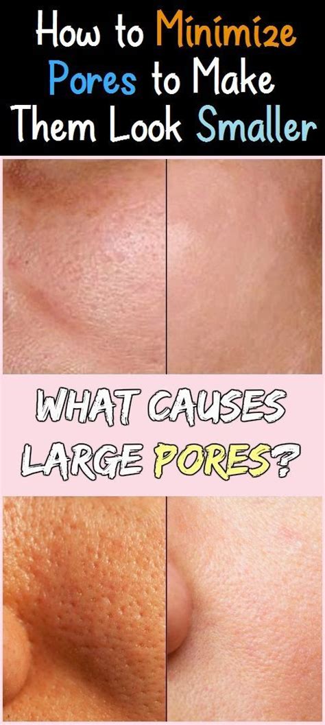 How To Minimize Pores To Make Them Look Smaller Minimize Pores Make