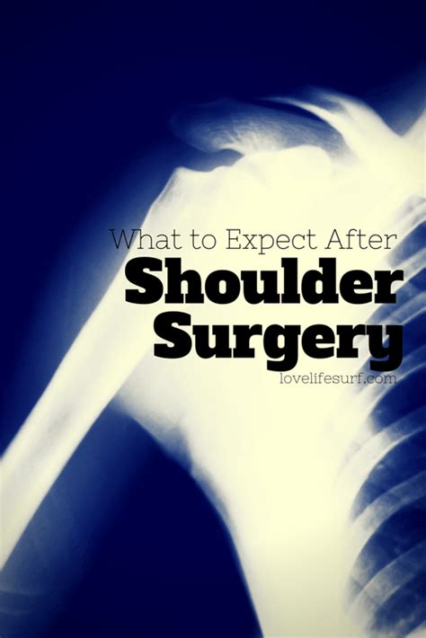 What To Expect After Shoulder Surgery Shoulder Surgery Recovery
