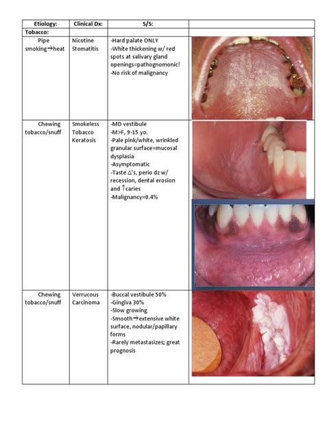 Oral Pathology Pdf Skin Cancer Medical Specialties