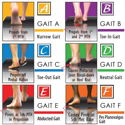 Attaining Successful Orthotic Outcomes Through Functional Foot Typing