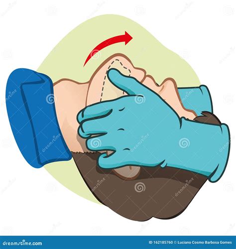 First Aid Person Opening The Mouth Clearing Airway With Gloves Vector