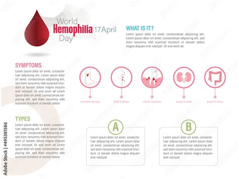Infographic World Hemophilia Day What Is Hemophilia Symptoms And Types With Icons Of The