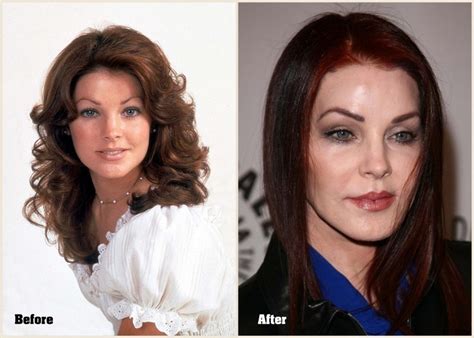 Priscilla Presley Plastic Surgery Before And Af