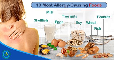 Not all people with allergies are at risk of anaphylaxis. Things to Know About 10 Allergy-causing Food