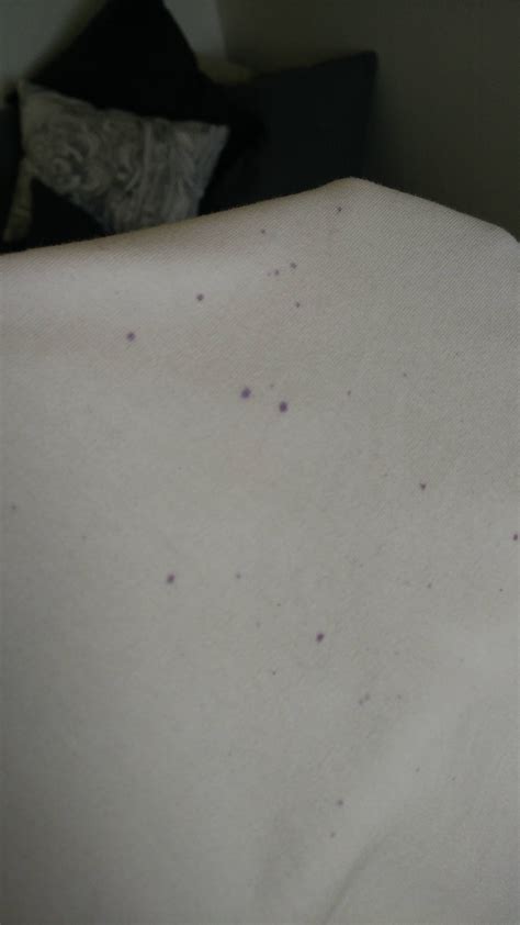 Reddit Why Did These Purple Spots Appear Overnight On My Work Clothes