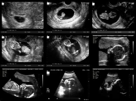 Thanks to medical advancements, many of those events in the life of a baby in womb can be tracked through various. Pregnancy Ultrasound - 3D & 4D | UC San Diego Health