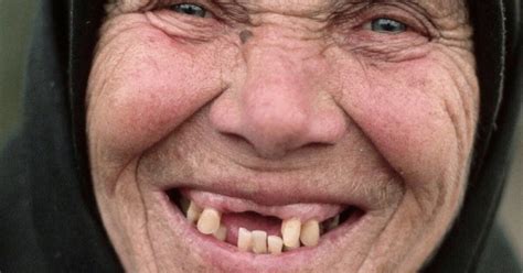 Fotos De Pessoas Sem Dentes