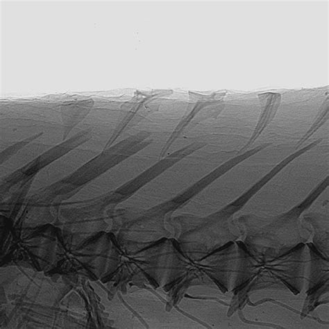 Radiograph Of The Anterior Part Of The Dorsal Fin Skeleton In