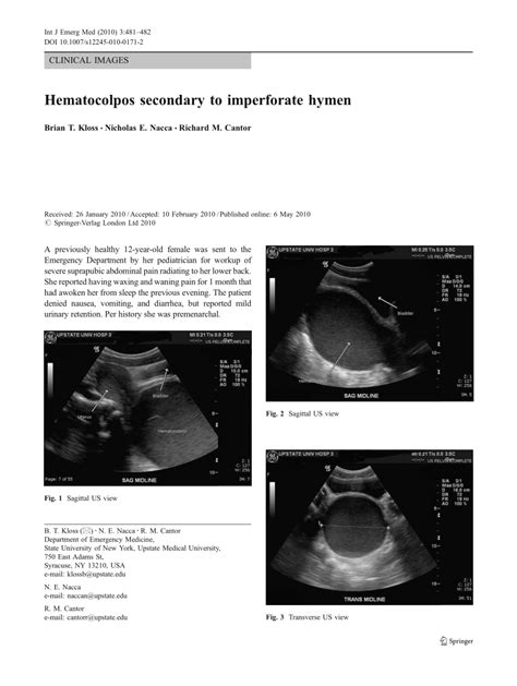 Hematocolpos Sur Imperforation Hymeneale A Propos De 3 Cas