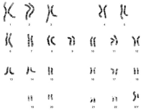 Patterns Of Inheritance Bio103 Human Biology