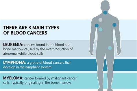 Blood Cancers At A Glance The Globe And Mail