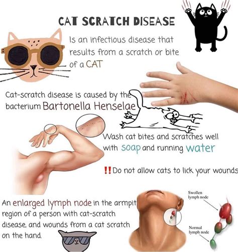 Medgag Cat Scratch Disease Is An Illness Caused By The