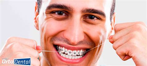 ¿cómo Usar El Hilo Dental Con Brackets Ortodental Ortodoncista En