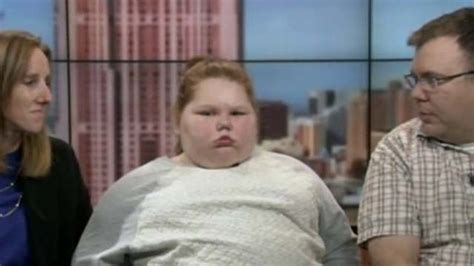 Alexis Shapiro Obese Girl 12 Fights For Gastric Bypass