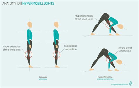 Anatomy 101 Hypermobile Joints — Yogaru
