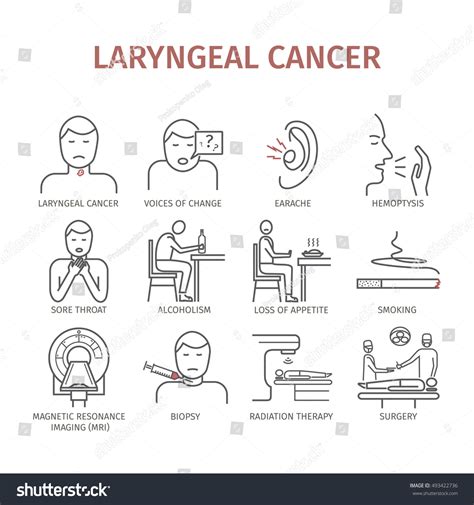 Laryngeal Cancer Symptoms Causes Treatment Line 库存矢量图（免版税）493422736