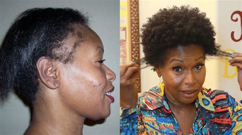Some women opt for a super low haircut when they just don't feel like having to deal with styling their hair on a daily basis. How I Repaired My Thinning Edges - YouTube