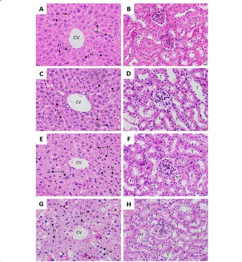 Histopathology Of The Liver And Kidney Of Mice During The Acute