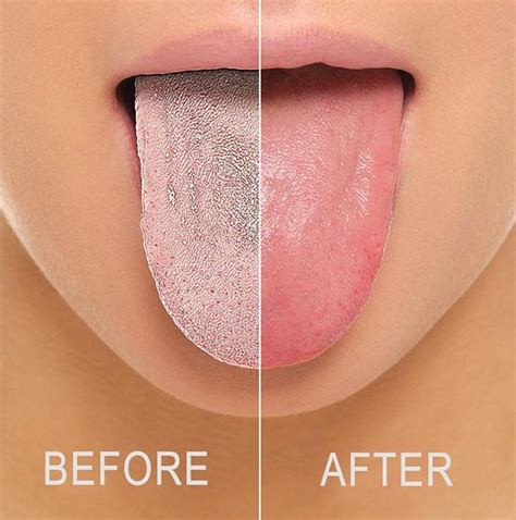 How to clean your tongue: Tongue Scraper Cleaner - Speedy Wish