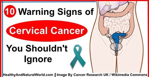 10 Warning Signs Of Cervical Cancer You Shouldnt Ignore